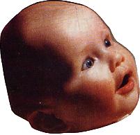 Parents: Check the shape of your baby's head!